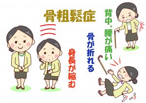 骨粗鬆症